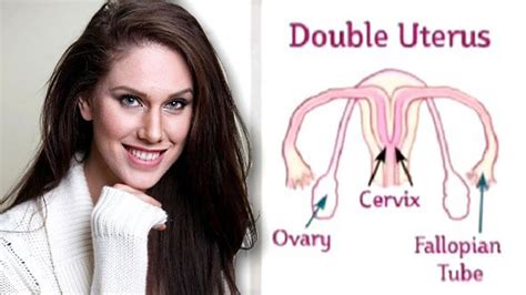 can women have 2 vaginas|Woman with uterus didelphys reveals what it’s like to have two。